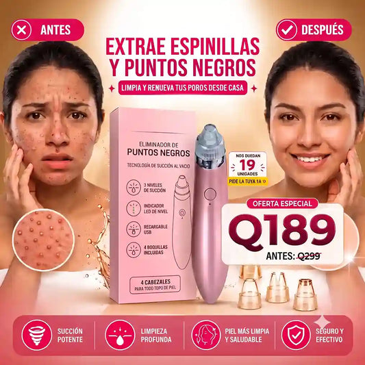Extractor Eléctrico de puntos Negros